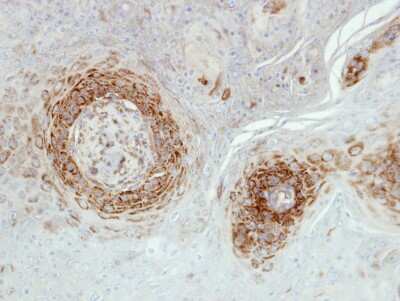 Immunohistochemistry-Paraffin: NDUFA5 Antibody [NBP1-33504] - Paraffin-embedded Cal27 xenograft, using antibody at 1:500 dilution.