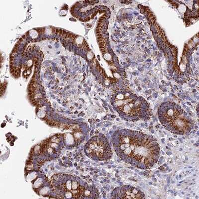 Immunohistochemistry-Paraffin: NDUFA5 Antibody [NBP1-88933] - Staining of human colon shows strong cytoplasmic positivity(granular pattern) in glandular cells.