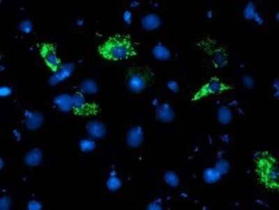 Immunocytochemistry/Immunofluorescence: NDUFA5 Antibody (OTI1E8) - Azide and BSA Free [NBP2-72904] - Staining of COS7 cells transiently transfected by pCMV6-ENTRY NDUFA5.