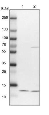 Western Blot: NDUFA5 Antibody [NBP1-88933] - Lane 1: NIH-3T3 cell lysate (Mouse embryonic fibroblast cells). Lane 2: NBT-II cell lysate (Rat Wistar bladder tumor cells).