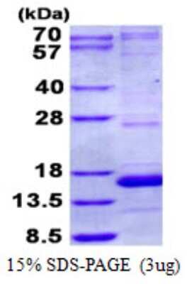 SDS-Page: NDUFA5 Protein [NBP2-23260]