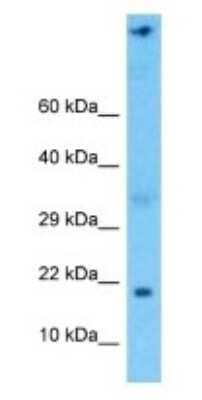 Western Blot NDUFA6 Antibody