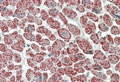 Immunohistochemistry-Paraffin: NDUFA7 Antibody [NBP2-26161] - Analysis of Human Heart shows mitochondrial staining in cardial fibres. Steamed antigen retrieval with citrate buffer pH 6, AP-staining.