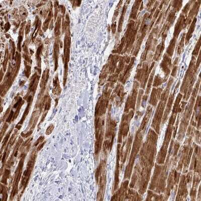 Immunohistochemistry-Paraffin: NDUFA7 Antibody [NBP2-31758] - Staining of human heart muscle shows strong cytoplasmic positivity in cardiomyocytes.