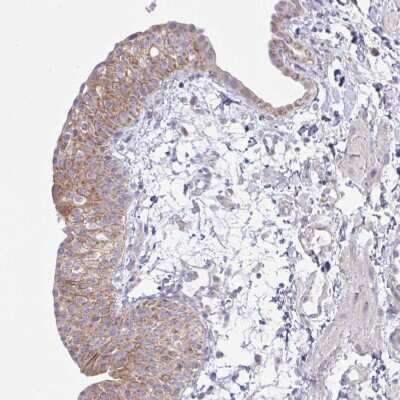 Immunohistochemistry-Paraffin: NDUFA7 Antibody [NBP2-31758] - Staining of human fallopian tube shows moderate cytoplasmic positivity in glandular cells.