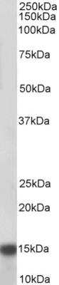 Western Blot: NDUFA7 Antibody [NBP2-26161] - Pig Heart lysate (35 ug protein in RIPA buffer). Primary incubation was 1 hour. Detected by chemiluminescence.