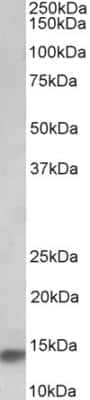 Western Blot: NDUFA7 Antibody [NBP2-26162] - Staining of Human Heart lysate (35 ug protein in RIPA buffer). Primary incubation was 1 hour. Detected by chemiluminescence.  