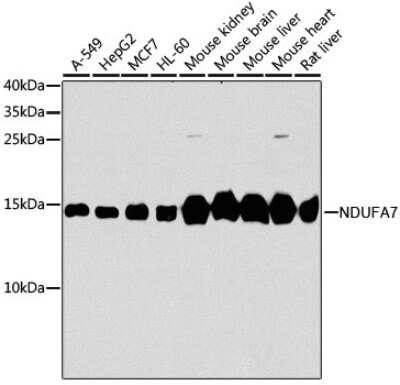 Western Blot: NDUFA7 Antibody [NBP3-03240] - Analysis of extracts of various cell lines, using NDUFA7 antibody at 1:1000 dilution. Secondary antibody: HRP Goat Anti-Rabbit IgG (H+L) at 1:10000 dilution. Lysates/proteins: 25ug per lane. Blocking buffer: 3% nonfat dry milk in TBST. Detection: ECL Basic Kit.