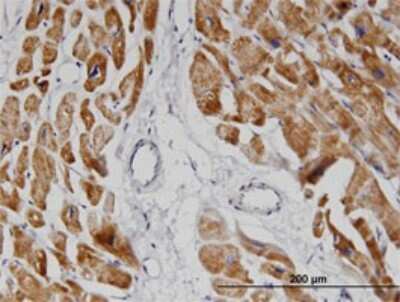 Immunohistochemistry-Paraffin: NDUFA8 Antibody (2E10) [H00004702-M05] - Analysis of monoclonal antibody to NDUFA8 on formalin-fixed paraffin-embedded human heart. Antibody concentration 3 ug/ml