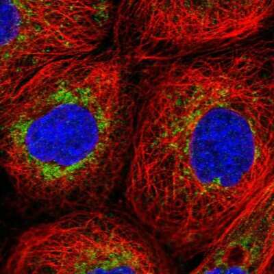 Immunocytochemistry/Immunofluorescence: NDUFA8 Antibody [NBP1-82662] - Immunofluorescent staining of human cell line A-431 shows localization to mitochondria.