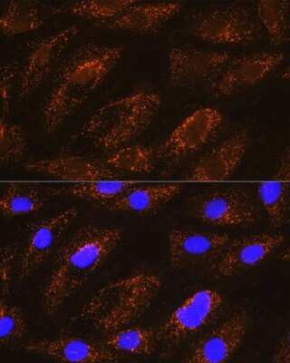 Immunocytochemistry/Immunofluorescence: NDUFA8 Antibody [NBP2-93802] - Immunofluorescence analysis of H9C2 cells using NDUFA8 Rabbit pAb (NBP2-93802) at dilution of 1:100 (40x lens). Blue: DAPI for nuclear staining.