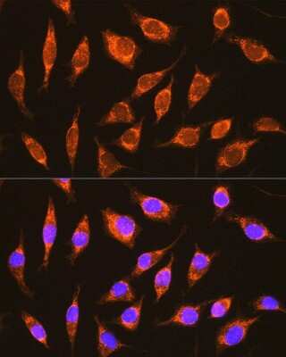 Immunocytochemistry/Immunofluorescence: NDUFA8 Antibody [NBP2-93802] - Immunofluorescence analysis of L929 cells using NDUFA8 Rabbit pAb (NBP2-93802) at dilution of 1:100 (40x lens). Blue: DAPI for nuclear staining.