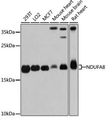 Western Blot: NDUFA8 Antibody [NBP2-93802] - Analysis of extracts of various cell lines, using NDUFA8 at 1:3000 dilution.Secondary antibody: HRP Goat Anti-Rabbit IgG (H+L) at 1:10000 dilution.Lysates/proteins: 25ug per lane.Blocking buffer: 3% nonfat dry milk in TBST.Detection: ECL Basic Kit .Exposure time: 30s.