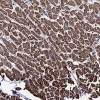 Immunohistochemistry-Paraffin: NDUFAB1 Antibody [NBP3-17896] - Staining of human heart muscle shows strong cytoplasmic positivity in myocytes.