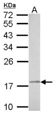 Western Blot: NDUFAB1 Antibody [NBP2-19502] - 30 ug PC-12 whole cell lysate/extract 12 % SDS-PAGE NDUFAB1 antibody dilution: 1:5000.