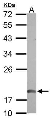 Western Blot: NDUFAB1 Antibody [NBP2-19502] - Sample (30 ug of whole cell lysate) A: 293T 12% SDS PAGE gel, diluted at 1:1000.