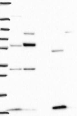 Western Blot: NDUFAB1 Antibody [NBP3-17896] - Lane 1: Marker [kDa] 250, 130, 95, 72, 55, 36, 28, 17, 10;   Lane 2: RT4;   Lane 3: U-251 MG;   Lane 4: Human Plasma;   Lane 5: Liver;   Lane 6: Tonsil