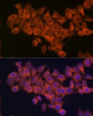 Immunocytochemistry/Immunofluorescence: NDUFAF1 Antibody (4K8Y8) [NBP3-16313] - Immunofluorescence analysis of HeLa cells using NDUFAF1 Rabbit mAb (NBP3-16313) at dilution of 1:100 (40x lens). Blue: DAPI for nuclear staining.