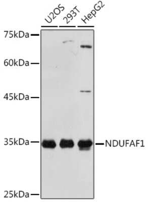 Western Blot: NDUFAF1 Antibody (4K8Y8) [NBP3-16313] - Western blot analysis of extracts of various cell lines, using NDUFAF1 Rabbit mAb (NBP3-16313) at 1:1000 dilution. Secondary antibody: HRP Goat Anti-Rabbit IgG (H+L) at 1:10000 dilution. Lysates/proteins: 25ug per lane. Blocking buffer: 3% nonfat dry milk in TBST. Detection: ECL Basic Kit. Exposure time: 10s.