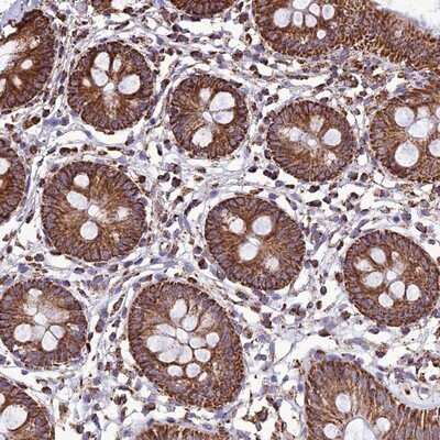 Immunohistochemistry-Paraffin: NDUFAF1 Antibody [NBP1-84504] - Staining of human colon shows strong granular cytoplasmic positivity in glandular cells.