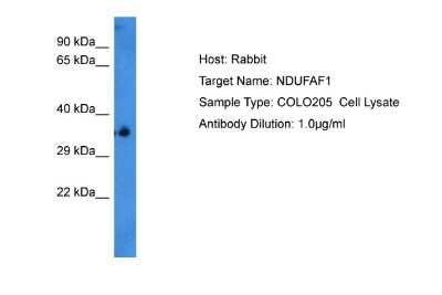 Western Blot: NDUFAF1 Antibody [NBP2-85365] - Host: Rabbit. Target Name: NDUFAF1. Sample Tissue: Human COLO205 Whole Cell. Antibody Dilution: 1.0ug/ml