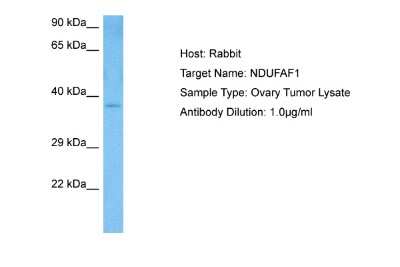 Western Blot: NDUFAF1 Antibody [NBP2-85367] - Host: Rabbit. Target Name: NDUFAF1. Sample Tissue: Human Ovary Tumor lysates. Antibody Dilution: 1ug/ml