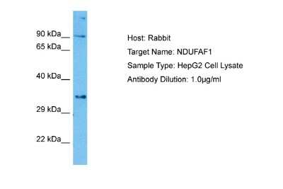 Western Blot: NDUFAF1 Antibody [NBP2-85368] - Host: Rabbit. Target Name: NDUFAF1. Sample Tissue: Human HepG2 Whole Cell lysates. Antibody Dilution: 1ug/ml