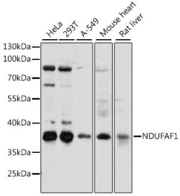 Western Blot: NDUFAF1 Antibody [NBP2-94232] - Analysis of extracts of various cell lines, using NDUFAF1 at 1:1000 dilution.Secondary antibody: HRP Goat Anti-Rabbit IgG (H+L) at 1:10000 dilution.Lysates/proteins: 25ug per lane.Blocking buffer: 3% nonfat dry milk in TBST.Detection: ECL Basic Kit .Exposure time: 35s.