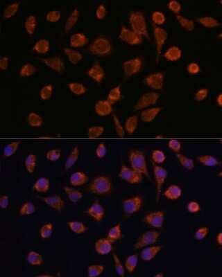 Immunocytochemistry/Immunofluorescence: NDUFAF2 Antibody [NBP2-93263] - Analysis of L929 cells using NDUFAF2 at dilution of 1:100. Blue: DAPI for nuclear staining.