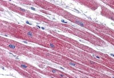 Immunohistochemistry-Paraffin: NDUFAF2 Antibody [NBP1-72135] - Staining of human heart. Immunohistochemistry of formalin-fixed, paraffin-embedded tissue after heat-induced antigen retrieval. Antibody concentration 5 ug/ml.