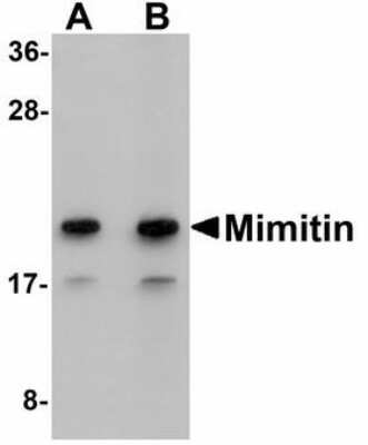 Western Blot: NDUFAF2 Antibody [NBP1-72135] - Western blot of Mimitin in Raji cell lysate with Mimitin antibody at (A) 1 and (B) 2 ug/ml.