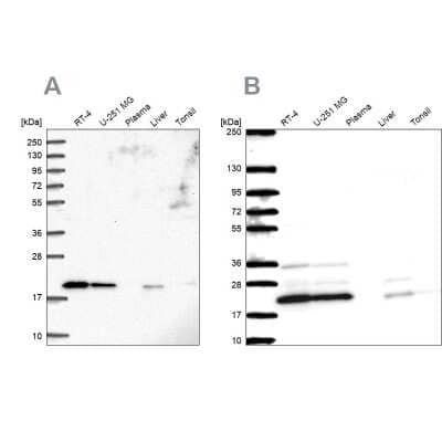 Western Blot: NDUFAF2 Antibody [NBP2-56048] - Analysis using Anti-NDUFAF2 antibody NBP2-56048 (A) shows similar pattern to independent antibody NBP2-47359 (B).