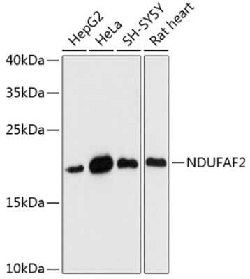 Western Blot: NDUFAF2 Antibody [NBP2-93263] - Analysis of extracts of various cell lines, using NDUFAF2 at 1:3000 dilution.Secondary antibody: HRP Goat Anti-Rabbit IgG (H+L) at 1:10000 dilution.Lysates/proteins: 25ug per lane.Blocking buffer: 3% nonfat dry milk in TBST.Detection: ECL Basic Kit .Exposure time: 90s.