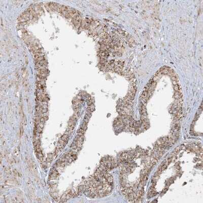 Immunohistochemistry: NDUFAF3 Antibody [NBP1-89382] - Staining of human prostate shows moderate granular cytoplasmic positivity in glandular cells.