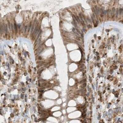 Immunohistochemistry-Paraffin: NDUFAF3 Antibody [NBP1-89382] - Staining of human colon.