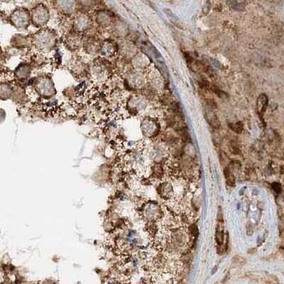 Immunohistochemistry-Paraffin: NDUFAF3 Antibody [NBP1-89382] - Staining of human testis.