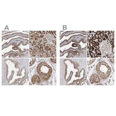 Immunohistochemistry-Paraffin: NDUFAF3 Antibody [NBP1-89382] - Staining of human fallopian tube, kidney, prostate and testis using Anti-NDUFAF3 antibody NBP1-89382 (A) shows similar protein distribution across tissues to independent antibody NBP2-48638 (B).