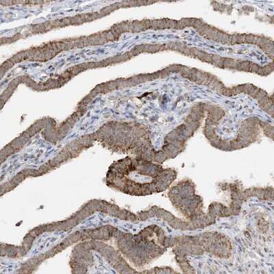 Immunohistochemistry-Paraffin: NDUFAF3 Antibody [NBP1-89382] - Staining of human Fallopian tube shows moderate granular cytoplasmic positivity in glandular cells.