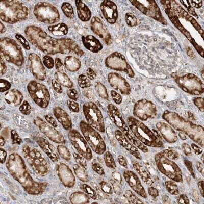 Immunohistochemistry-Paraffin: NDUFAF3 Antibody [NBP1-89382] - Staining of human kidney shows strong granular cytoplasmic positivity in cells in tubules.