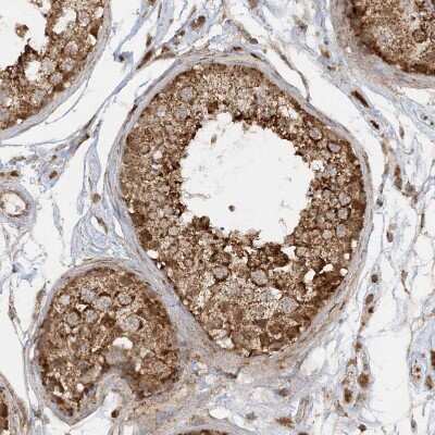 Immunohistochemistry-Paraffin: NDUFAF3 Antibody [NBP1-89382] - Staining of human testis shows strong granular cytoplasmic positivity in cells in seminiferous ducts.