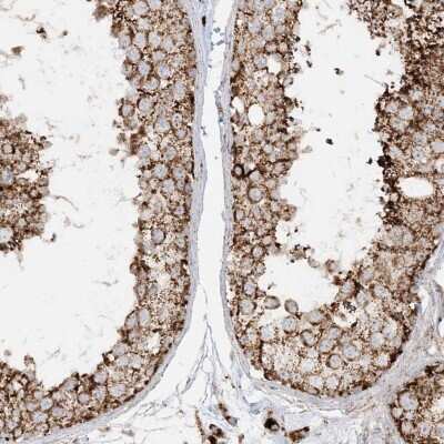 Immunohistochemistry-Paraffin: NDUFAF3 Antibody [NBP2-48638] - Staining of human testis shows strong cytoplasmic positivity in with a granular pattern in cells in seminiferous ducts.