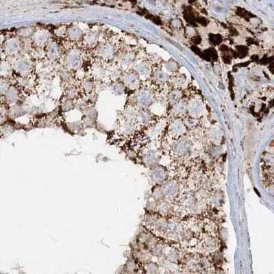 Immunohistochemistry-Paraffin: NDUFAF3 Antibody [NBP2-48638] - Staining of human testis.