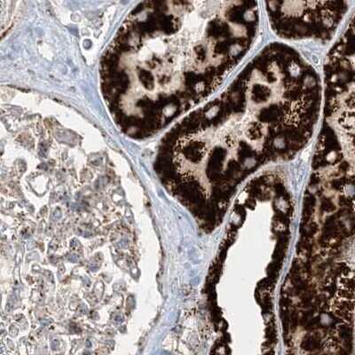 Immunohistochemistry-Paraffin: NDUFAF3 Antibody [NBP2-48638] - Staining of human kidney.