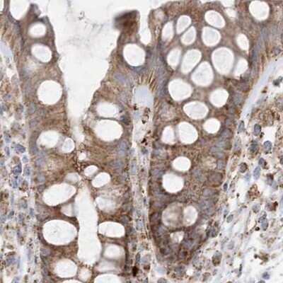 Immunohistochemistry-Paraffin: NDUFAF3 Antibody [NBP2-48638] - Staining of human colon.