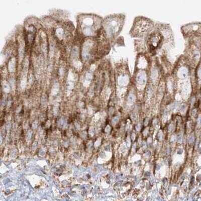 Immunohistochemistry-Paraffin: NDUFAF3 Antibody [NBP2-48638] - Staining of human urinary bladder.