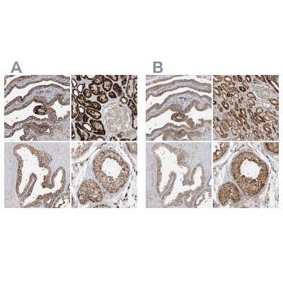 <b>Independent Antibodies Validation. </b>Immunohistochemistry-Paraffin: NDUFAF3 Antibody [NBP2-48638] - Staining of human fallopian tube, kidney, prostate and testis using Anti-NDUFAF3 antibody NBP2-48638 (A) shows similar protein distribution across tissues to independent antibody NBP1-89382 (B).