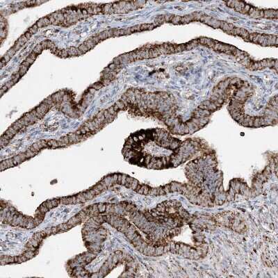 Immunohistochemistry-Paraffin: NDUFAF3 Antibody [NBP2-48638] - Staining of human Fallopian tube shows strong granular cytoplasmic positivity in glandular cells.