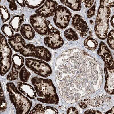 Immunohistochemistry-Paraffin: NDUFAF3 Antibody [NBP2-48638] - Staining of human kidney shows strong granular cytoplasmic positivity in cells in tubules.