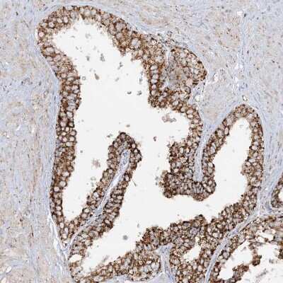 Immunohistochemistry-Paraffin: NDUFAF3 Antibody [NBP2-48638] - Staining of human prostate shows strong granular cytoplasmic positivity in glandular cells.