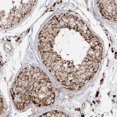 Immunohistochemistry-Paraffin: NDUFAF3 Antibody [NBP2-48638] - Staining of human testis shows strong granular cytoplasmic positivity in cells in seminiferous ducts.